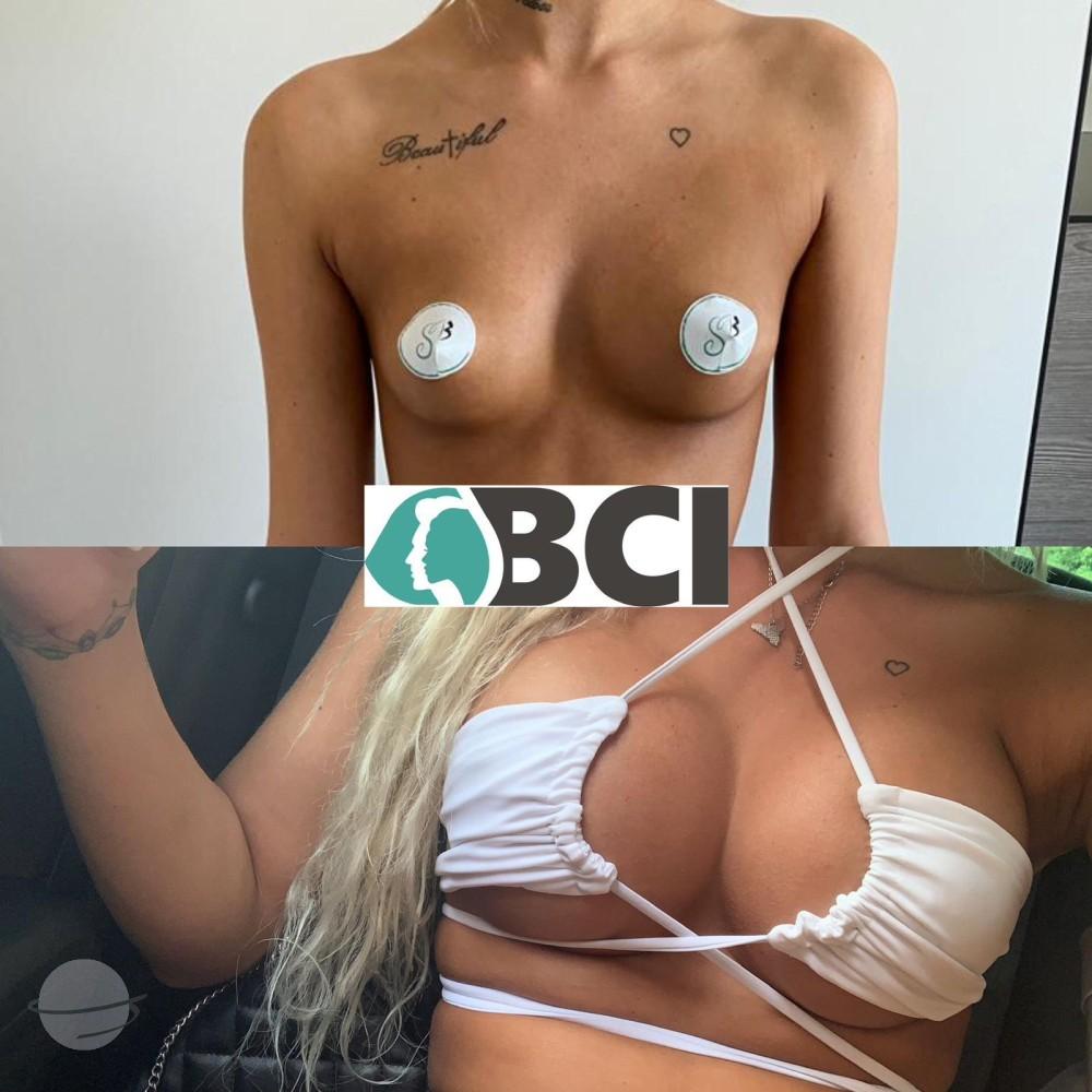 ELIT CLINIC COSMETIC SURGERY RESULTS 20