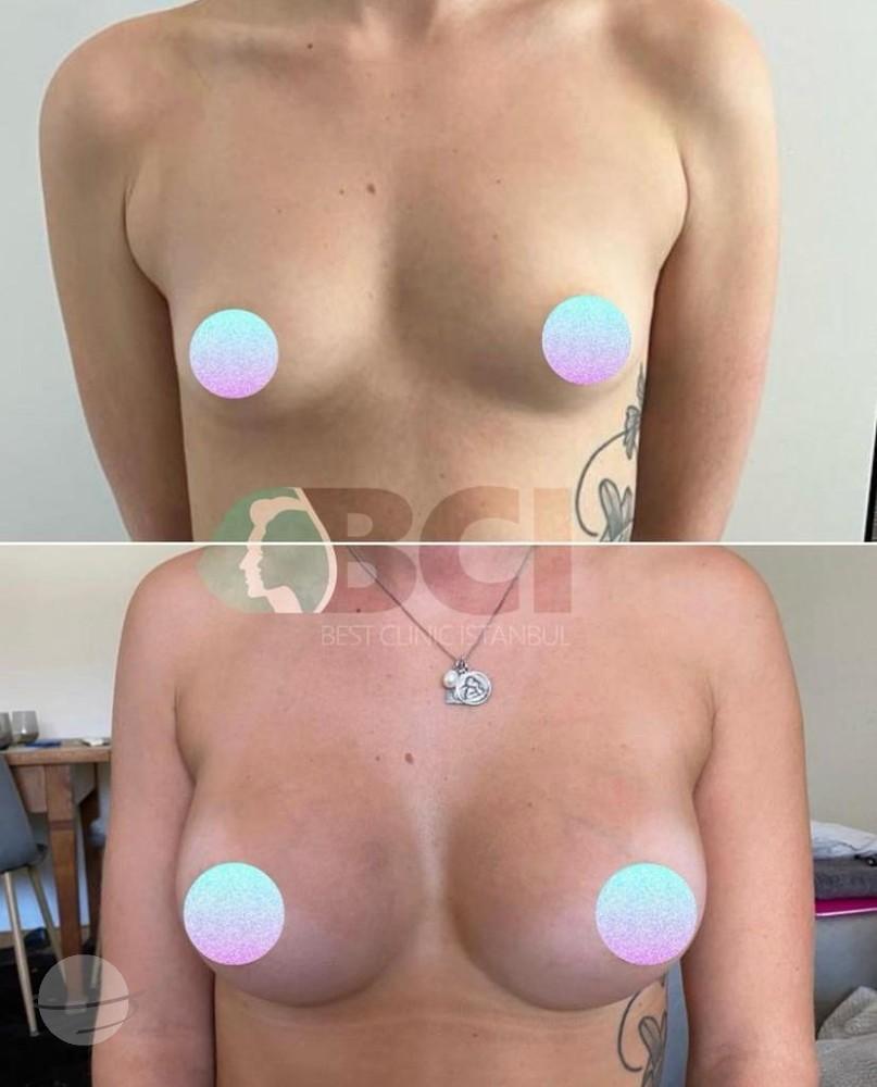 ELIT CLINIC COSMETIC SURGERY RESULTS 19