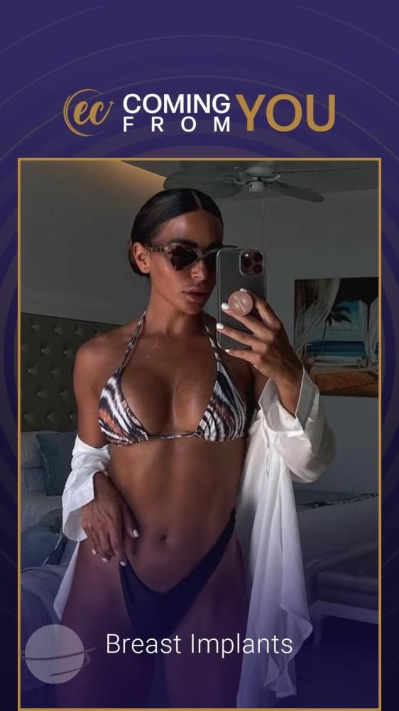 Cosmetic surgery Istanbul Before and after 22