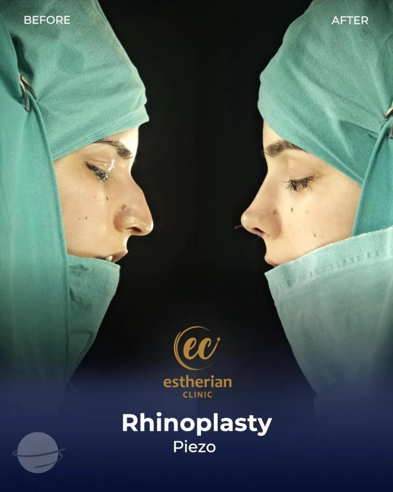 Estherian Clinic Istanbul results4