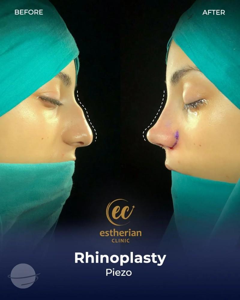 Estherian Clinic Istanbul results3