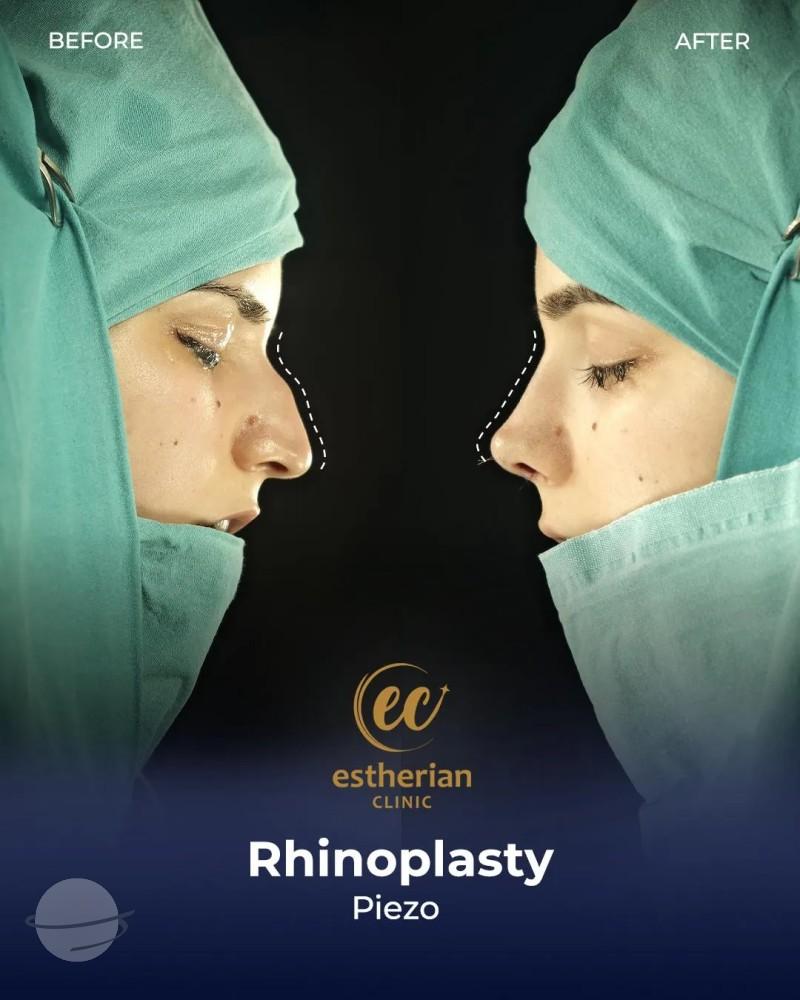 Estherian Clinic Istanbul results1