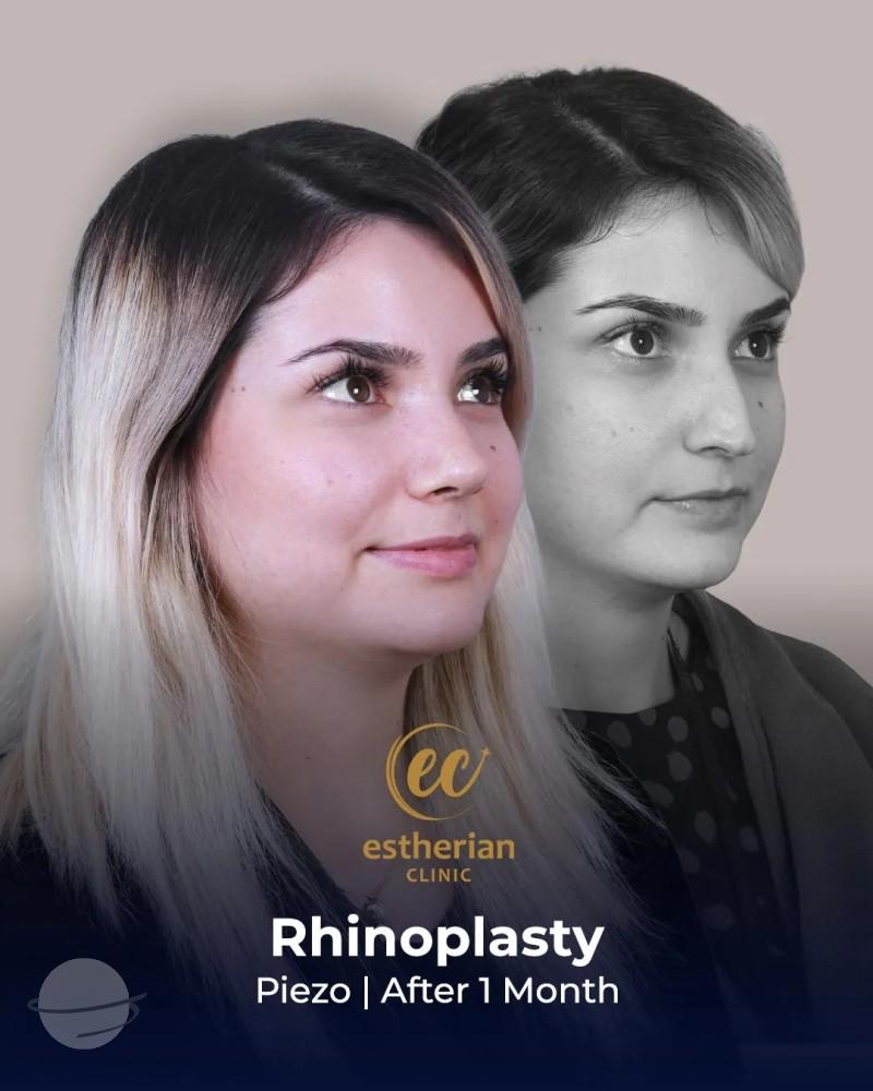 Estherian Clinic Istanbul results8