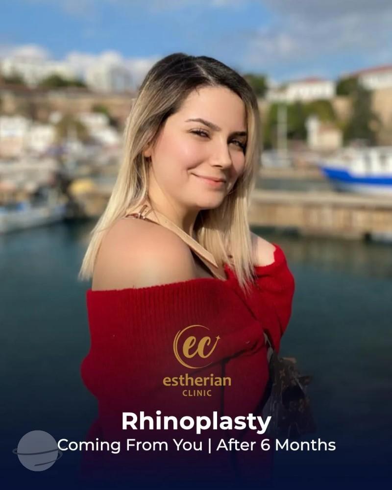 Estherian Clinic Istanbul results7