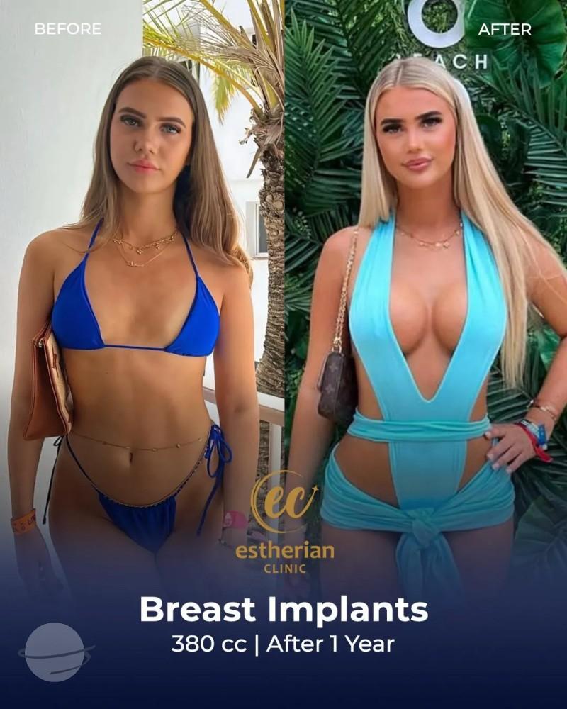 Estherian Clinic Istanbul results6