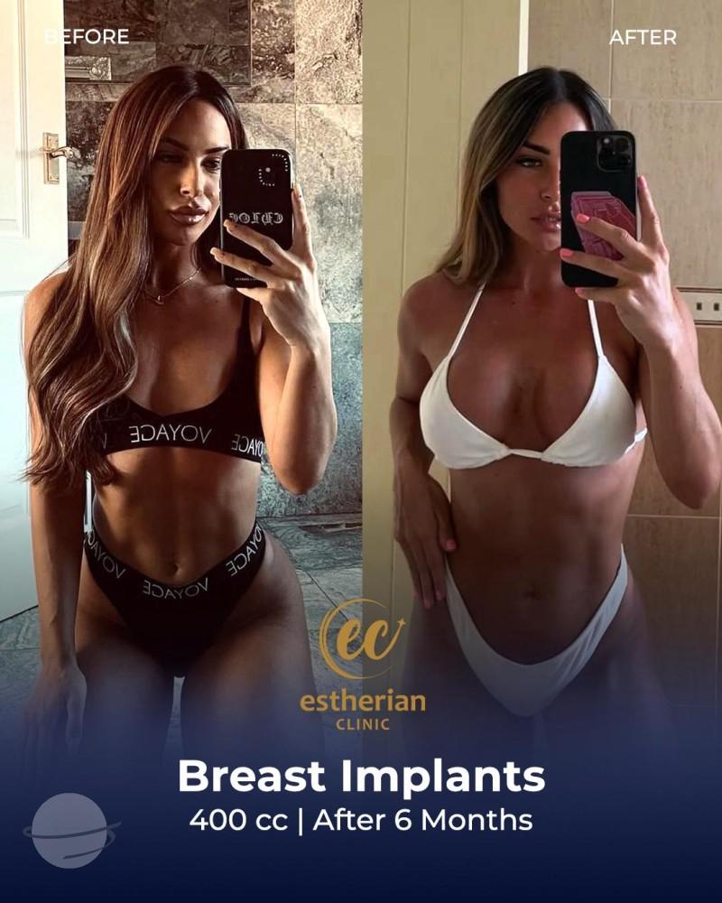 WhatsApp Image 2025-03-10 at 13.51.17