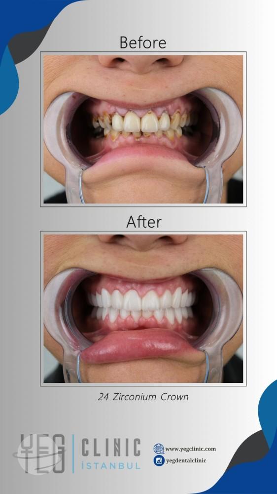 WhatsApp Image 2024-04-30 at 12.03.01