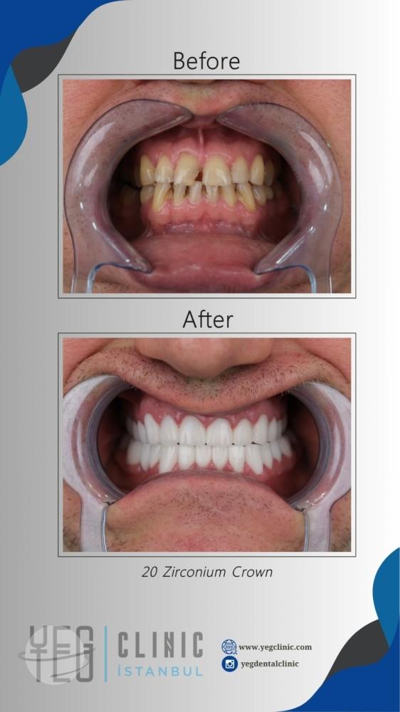 Yeg clinic dental istanbul