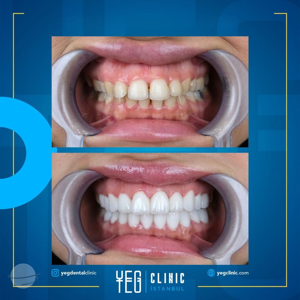 Yeg clinic dental istanbul