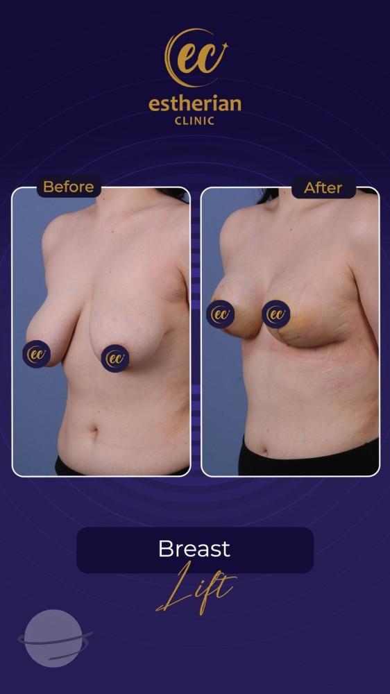 Estherian Istanbul on Esthetic Planet