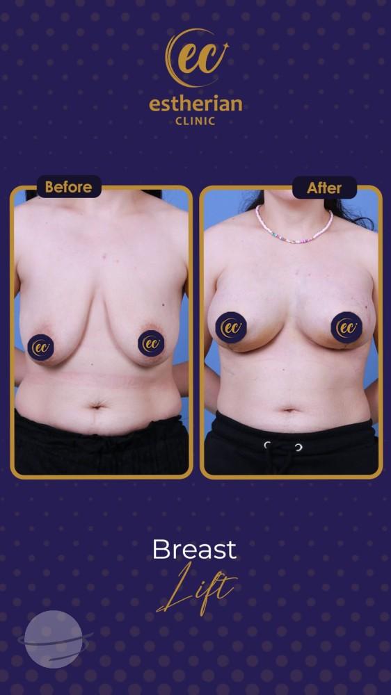 Estherian Istanbul on Esthetic Planet