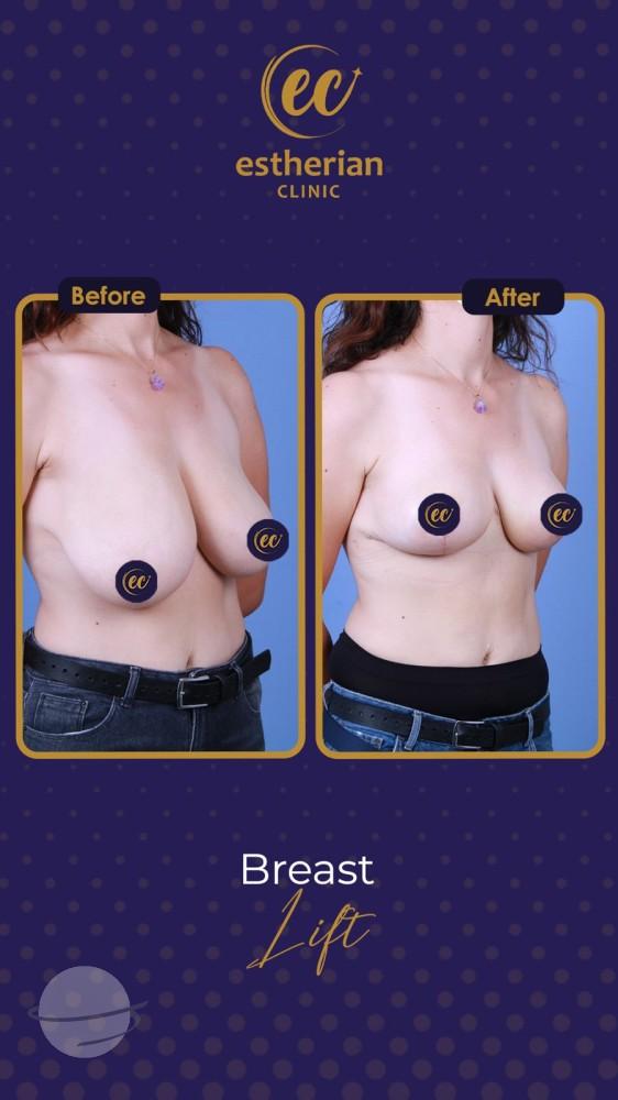 Estherian Istanbul on Esthetic Planet