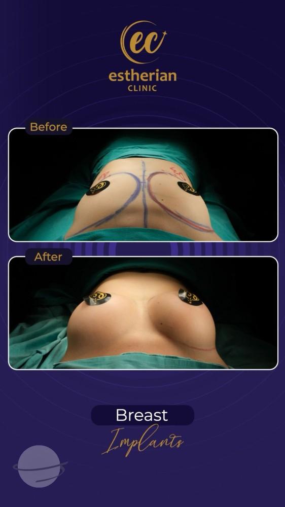 Estherian Istanbul on Esthetic Planet