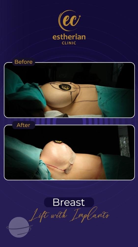 Estherian Istanbul on Esthetic Planet