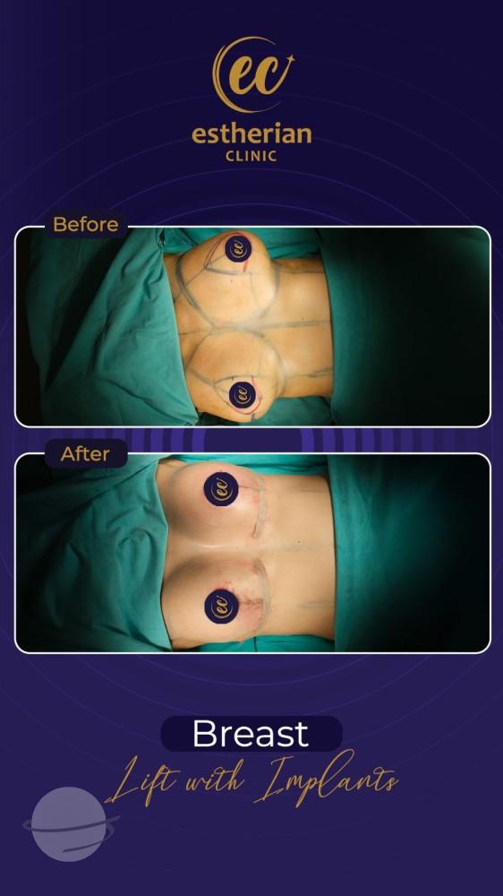 Estherian Istanbul on Esthetic Planet