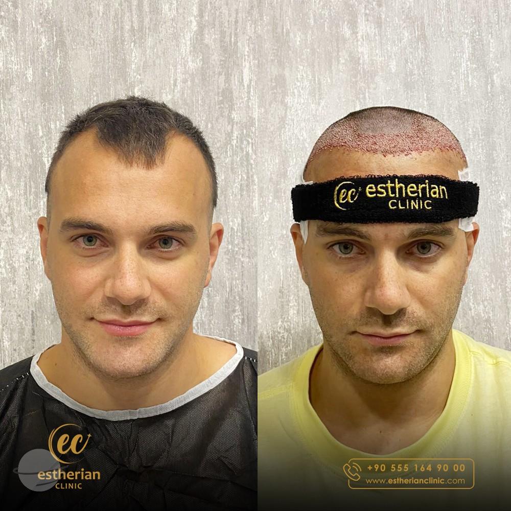 Estherian Istanbul on Esthetic Planet