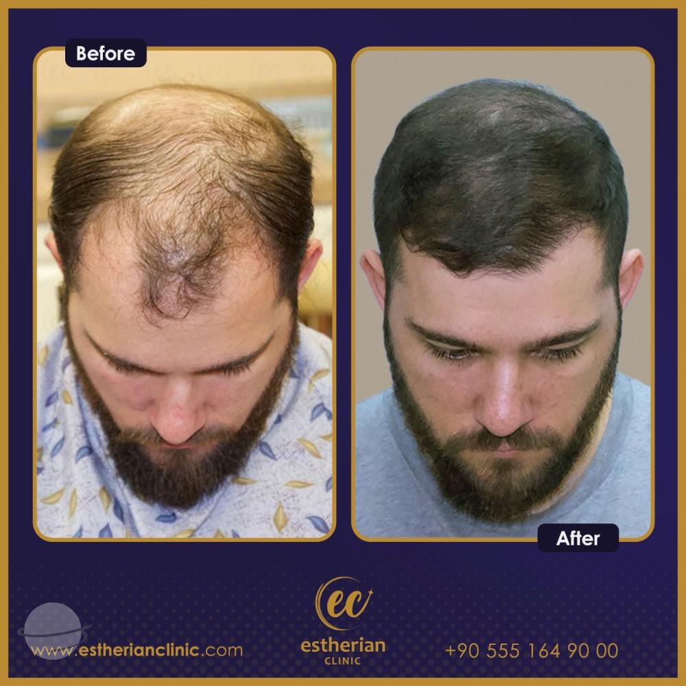 Estherian Istanbul on Esthetic Planet