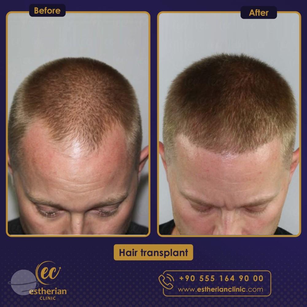 WhatsApp Image 2023-08-17 at 19.07.50