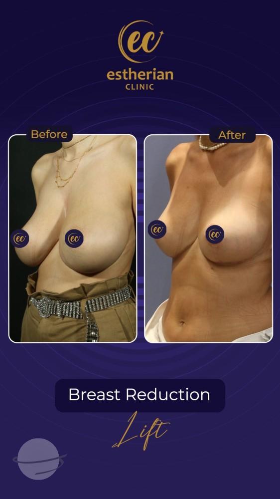 Estherian Istanbul on Esthetic Planet