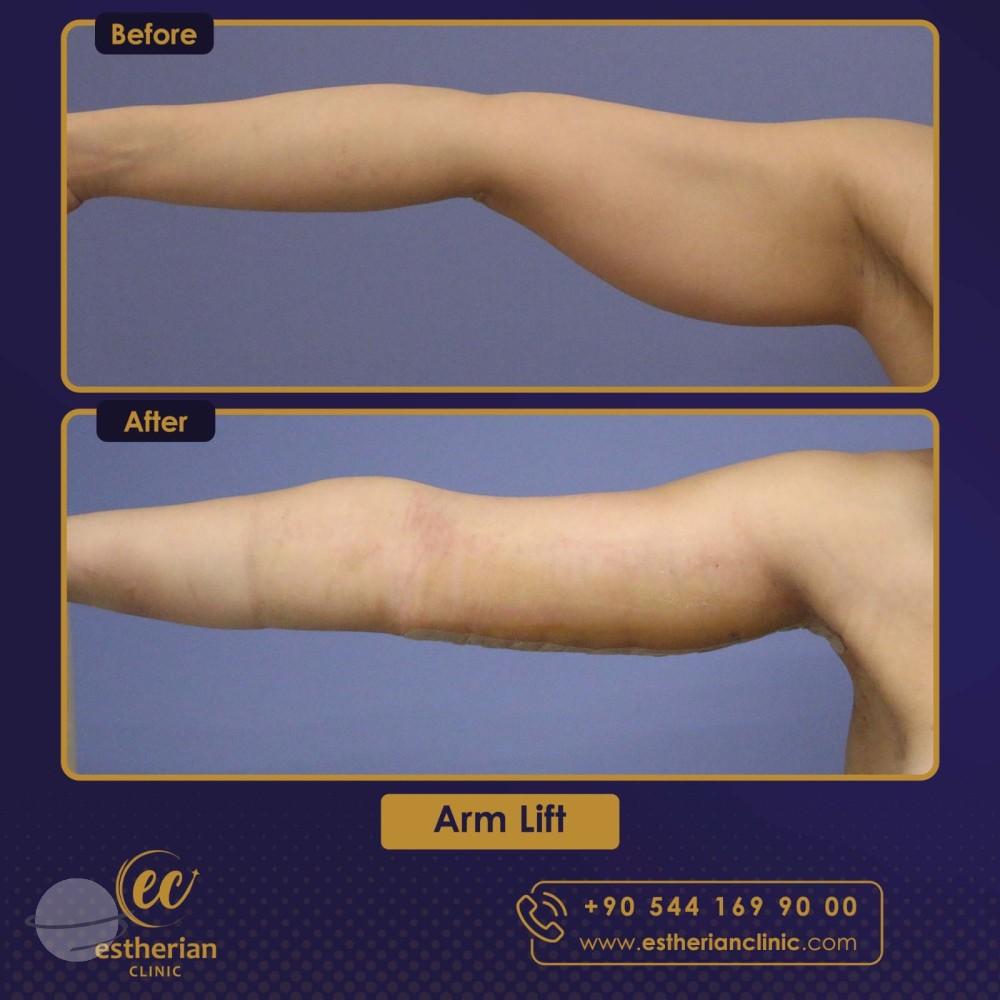 Estherian Istanbul on Esthetic Planet