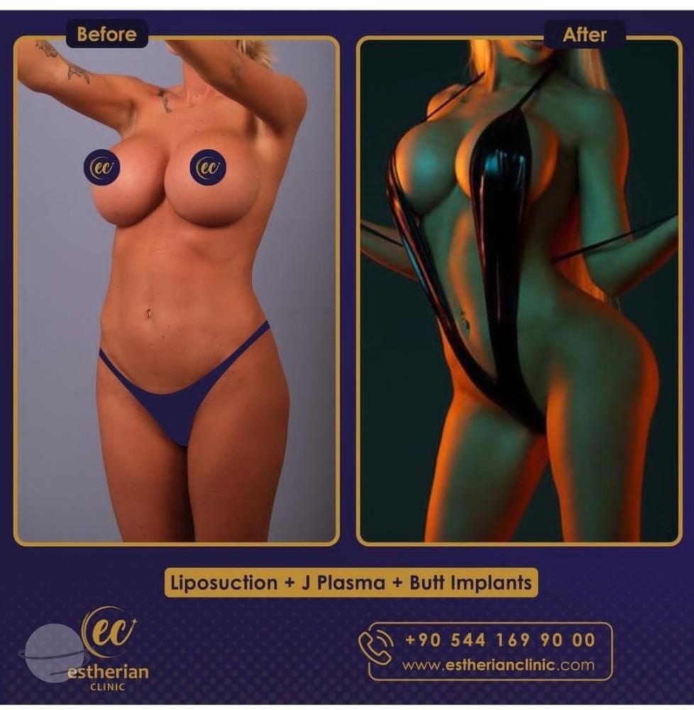 Estherian Istanbul on Esthetic Planet