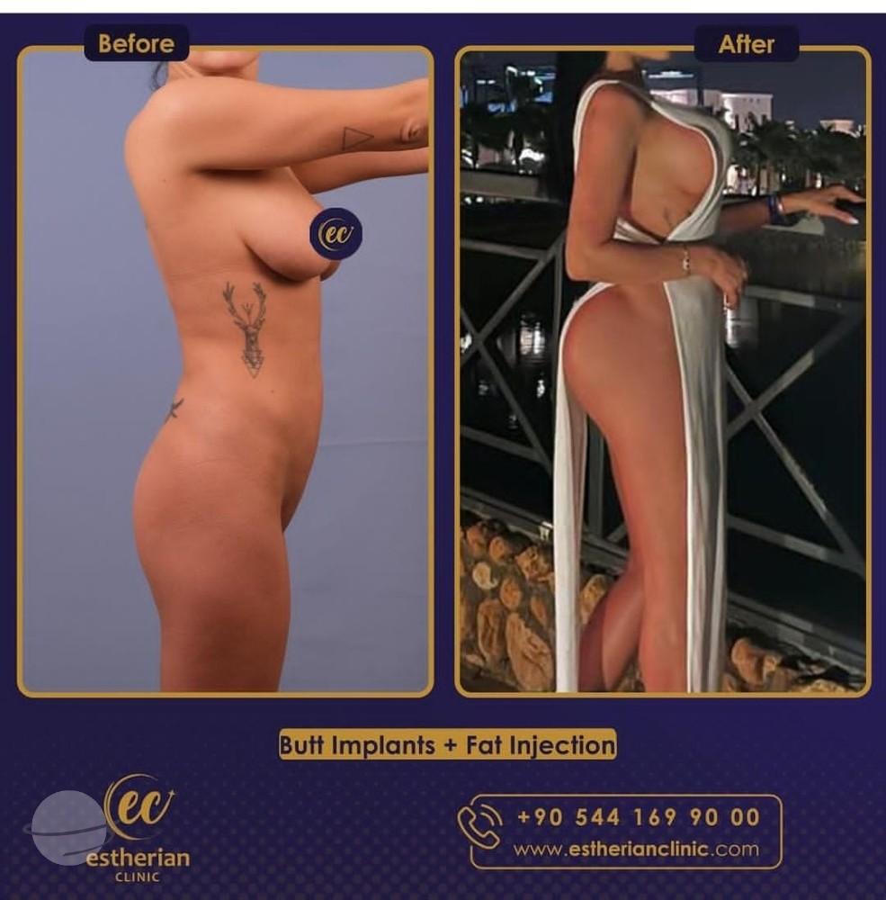 Estherian Istanbul on Esthetic Planet