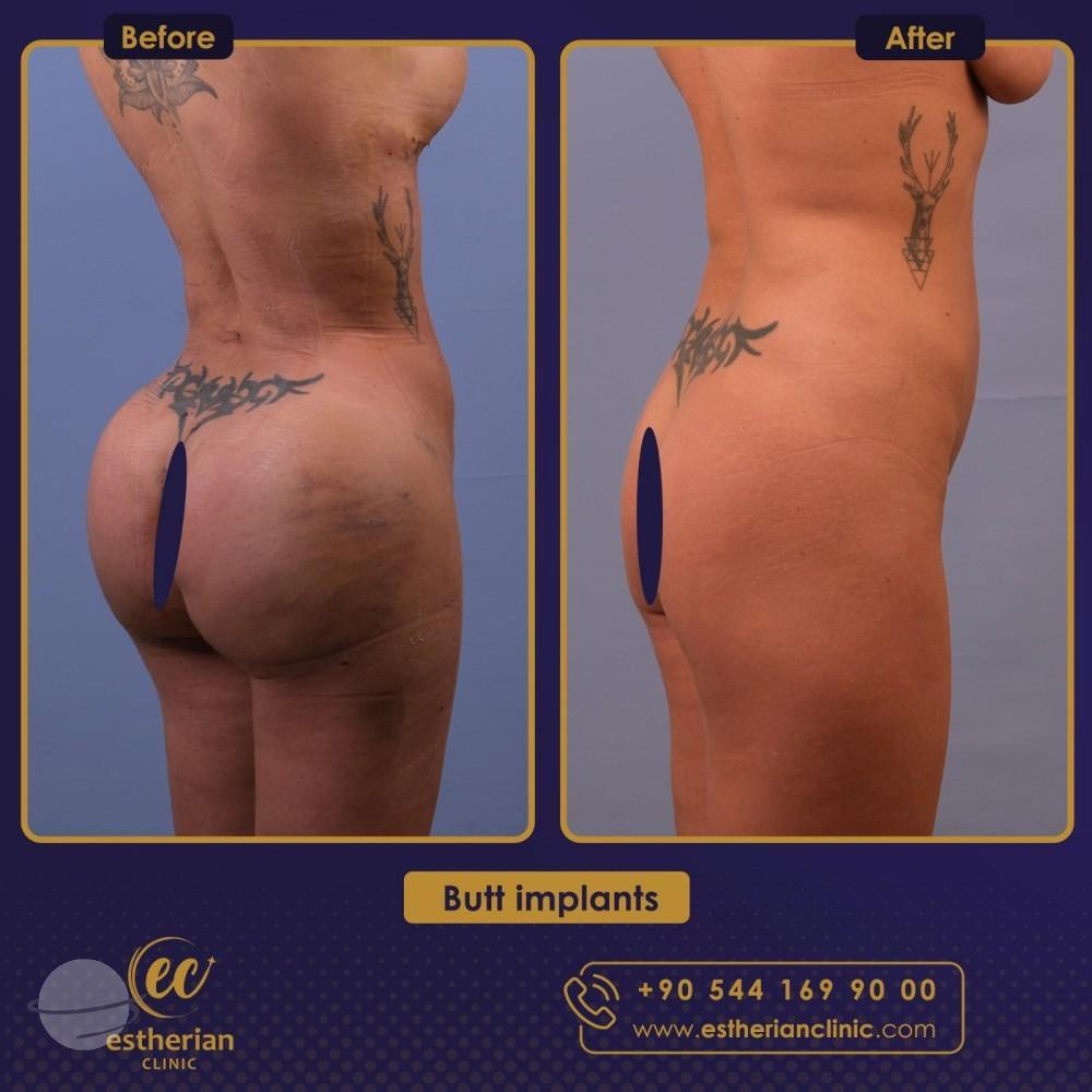 Estherian Istanbul on Esthetic Planet