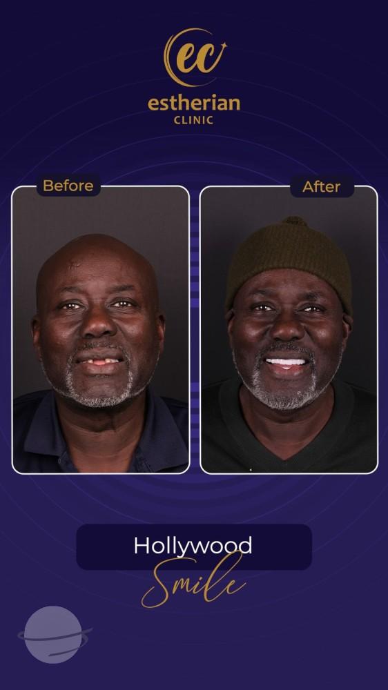 Estherian Istanbul on Esthetic Planet40522-WA0023