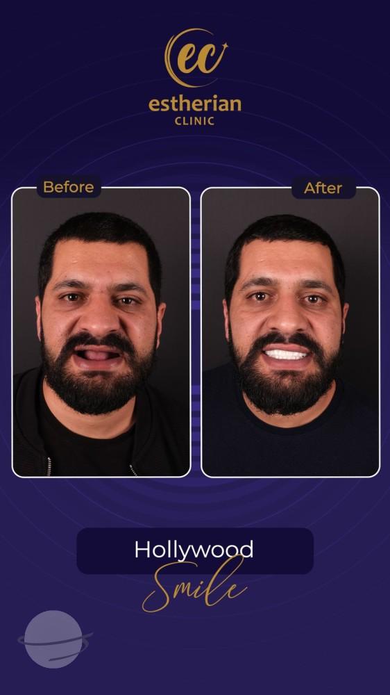 Estherian Istanbul on Esthetic Planet