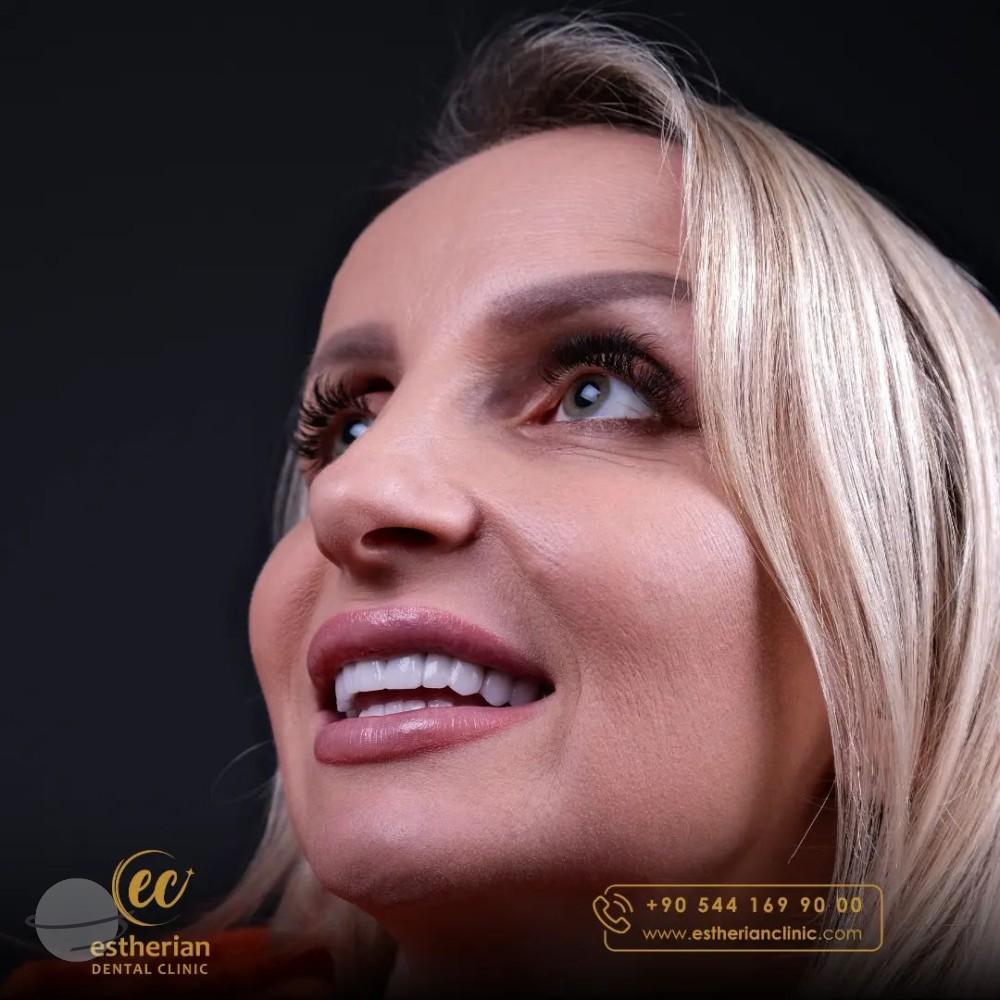 Estherian Istanbul on Esthetic Planet