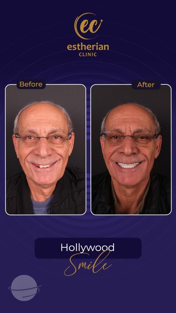 Estherian Istanbul on Esthetic Planet