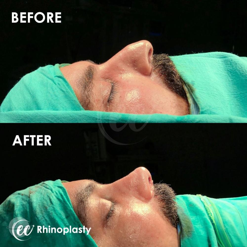 Estherian Istanbul on Esthetic Planet