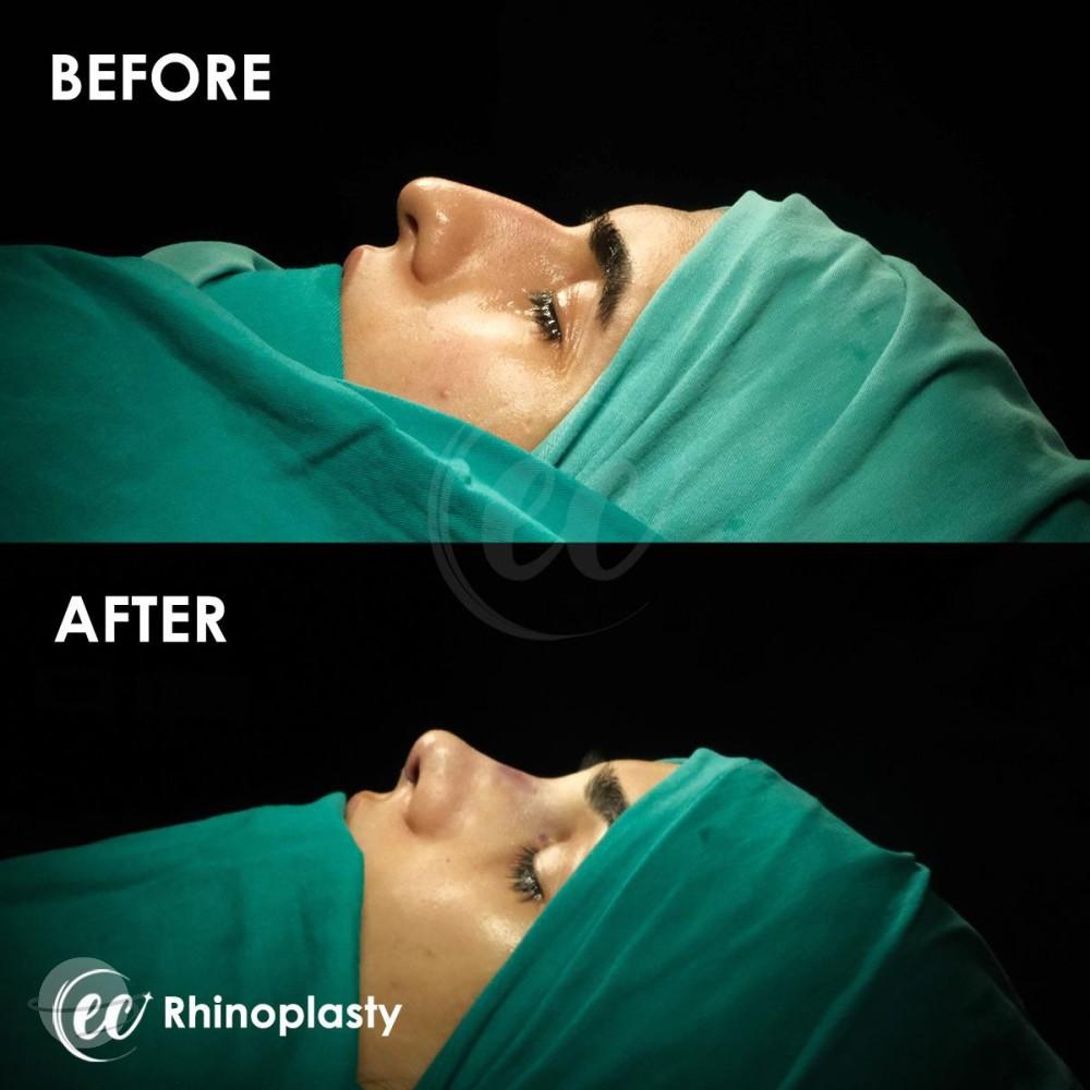 Estherian Istanbul on Esthetic Planet