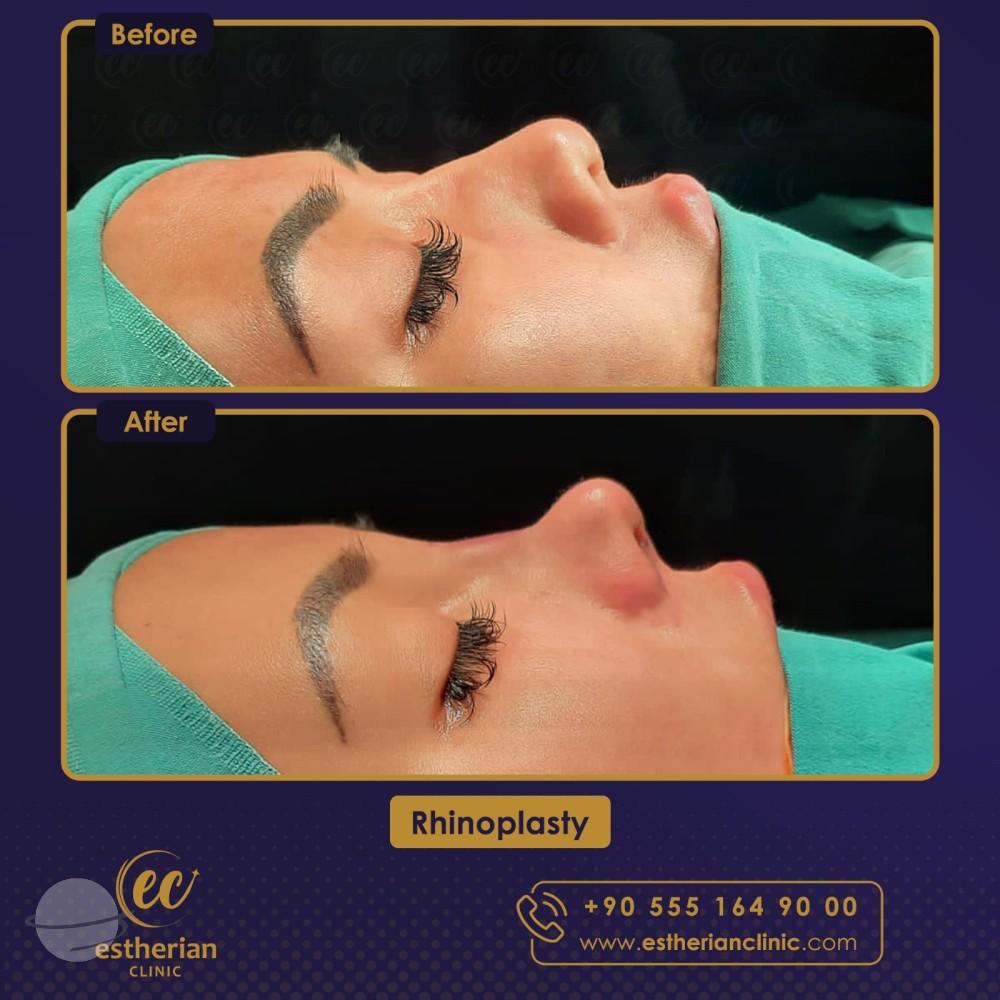 Estherian Istanbul on Esthetic Planet