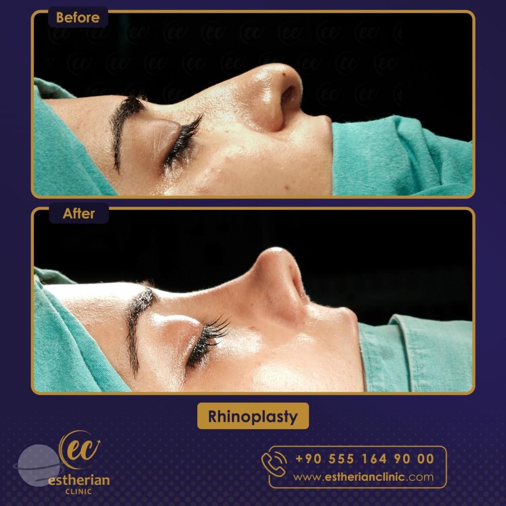 Estherian Istanbul on Esthetic Planet