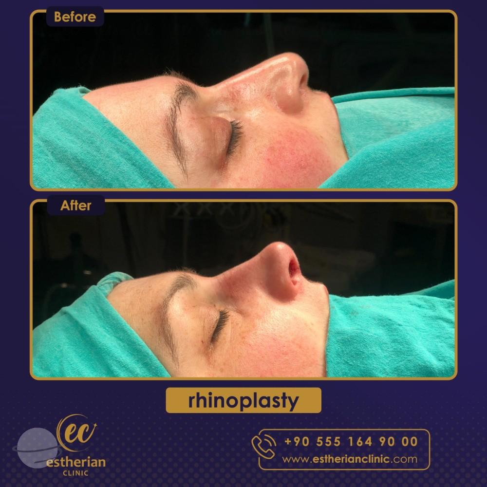 Estherian Istanbul on Esthetic Planet