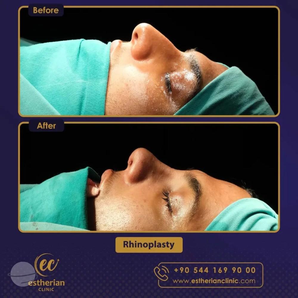 Estherian Istanbul on Esthetic Planet