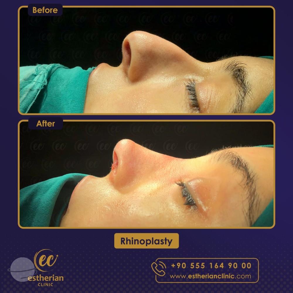 Estherian Istanbul on Esthetic Planet