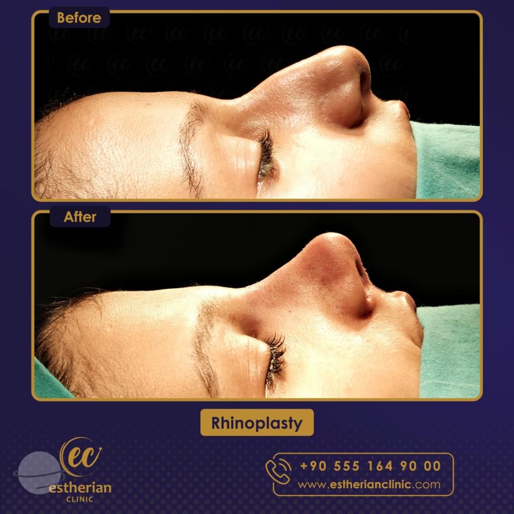 Estherian Istanbul on Esthetic Planet