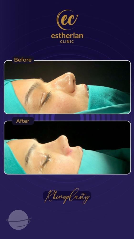 Estherian Istanbul on Esthetic Planet250212-WA0208