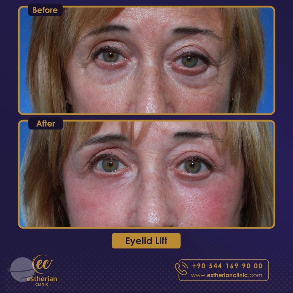 Estherian Istanbul on Esthetic Planet