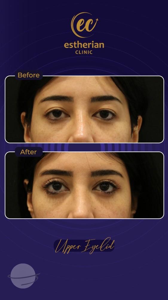 IMG-Estherian Istanbul on Esthetic Planet-WA0022