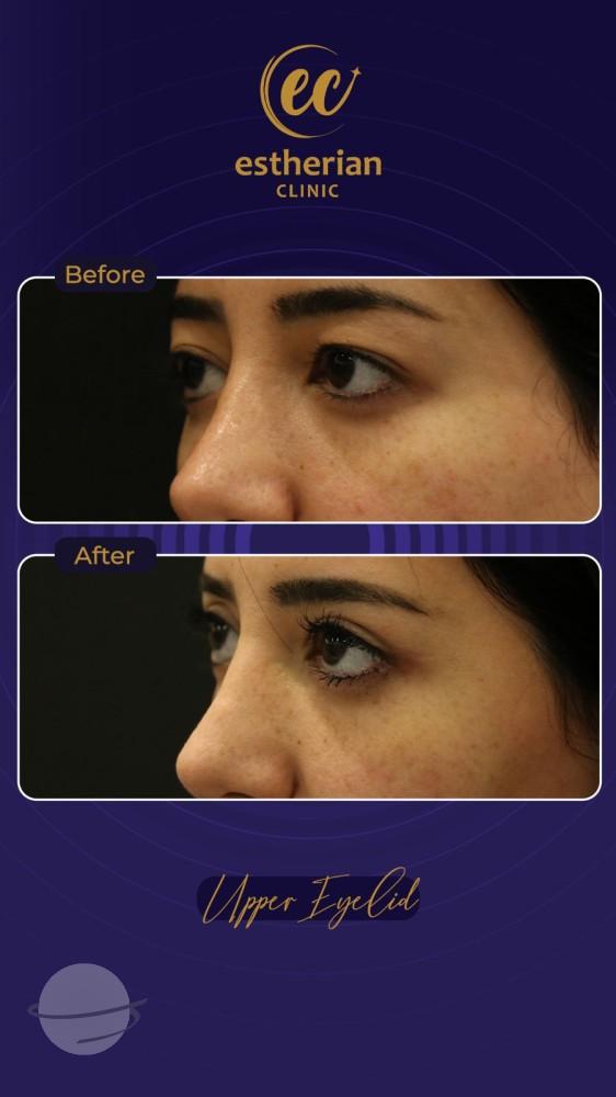 Estherian Istanbul on Esthetic Planet