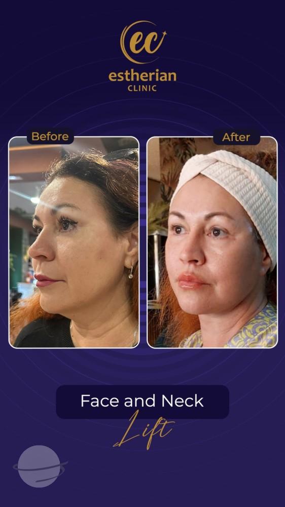 Estherian Istanbul on Esthetic Planet