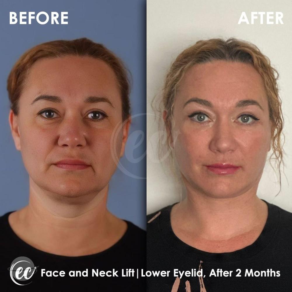 Estherian Istanbul on Esthetic Planet