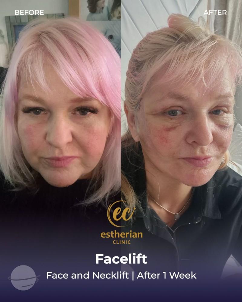 Estherian Istanbul on Esthetic Planet