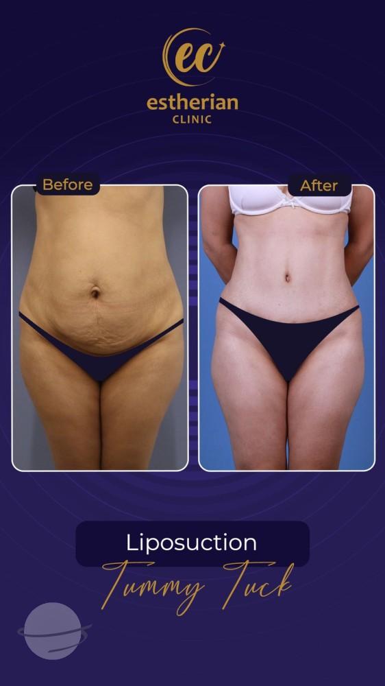 Estherian Istanbul on Esthetic Planet