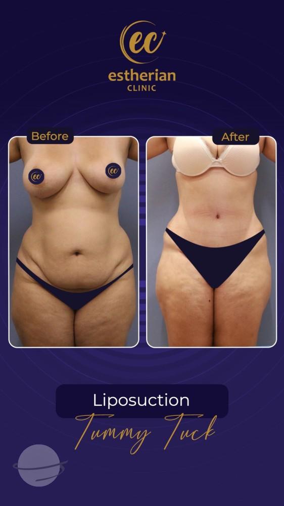 Estherian Istanbul on Esthetic Planet