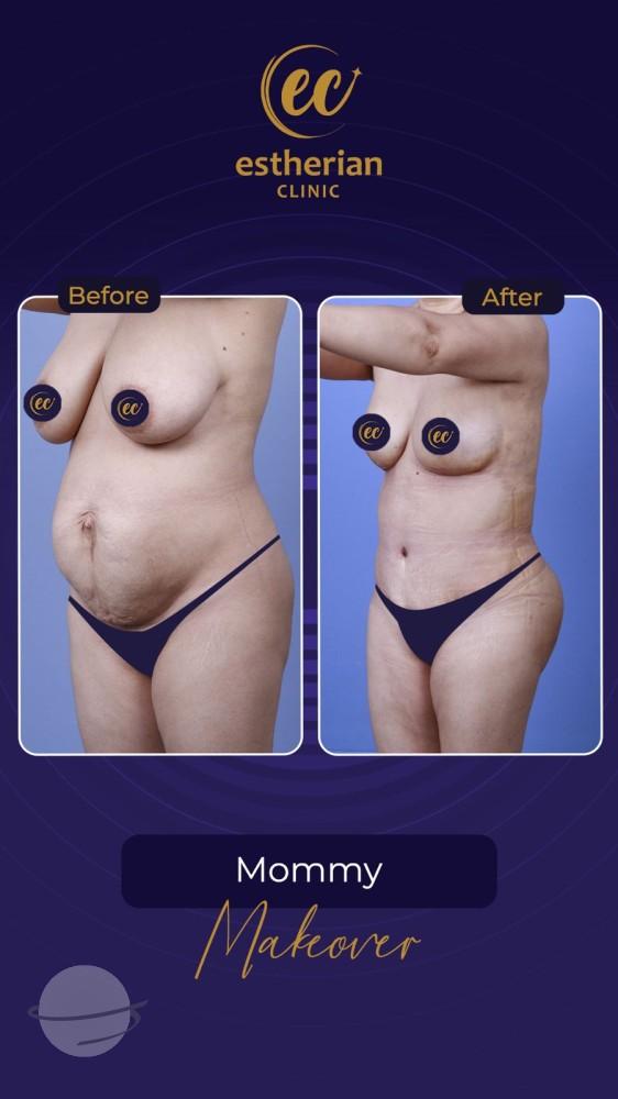 Estherian Istanbul on Esthetic Planet