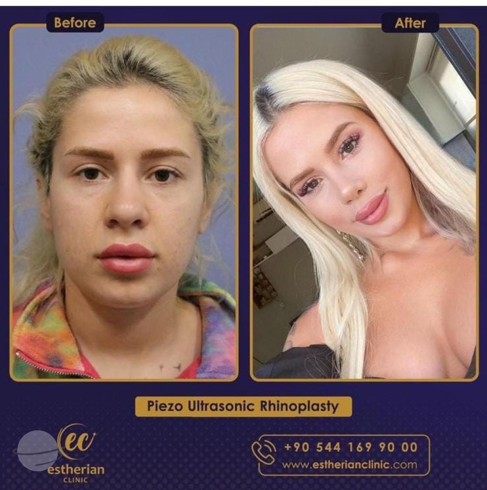 Estherian Istanbul on Esthetic Planet